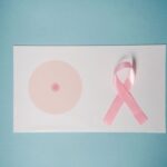 Tumore della mammella: come la diagnosi precoce e i protocolli personalizzati migliorano le prospettive di guarigione